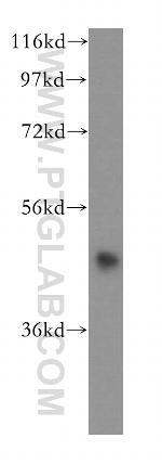 HDAC8 Antibody in Western Blot (WB)