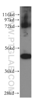 HDAC8 Antibody in Western Blot (WB)