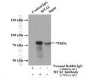 MTA2 Antibody in Immunoprecipitation (IP)