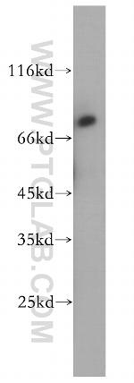 MTA2 Antibody in Western Blot (WB)