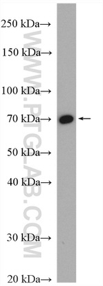 MTA2 Antibody in Western Blot (WB)