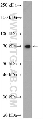 MTA2 Antibody in Western Blot (WB)