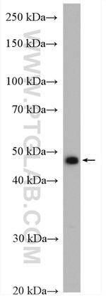 TRMT11 Antibody in Western Blot (WB)