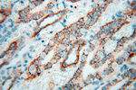 Calpain 9 Antibody in Immunohistochemistry (Paraffin) (IHC (P))