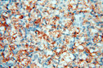 Calpain 9 Antibody in Immunohistochemistry (Paraffin) (IHC (P))