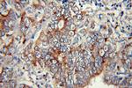 Calpain 9 Antibody in Immunohistochemistry (Paraffin) (IHC (P))