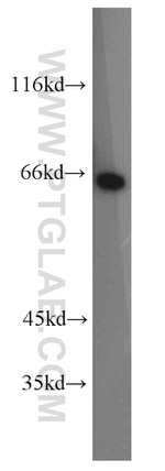 Calpain 9 Antibody in Western Blot (WB)