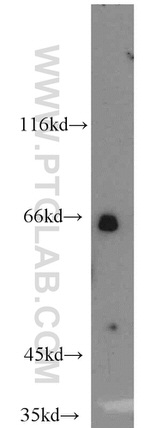 Calpain 9 Antibody in Western Blot (WB)