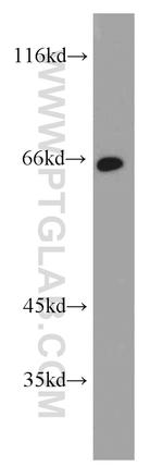 Calpain 9 Antibody in Western Blot (WB)