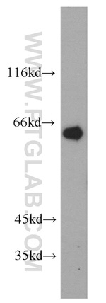 Calpain 9 Antibody in Western Blot (WB)