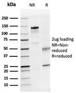 Dystrophin (DMD) (Marker of Duchenne and Becker Muscular Dystrophy) Antibody in SDS-PAGE (SDS-PAGE)