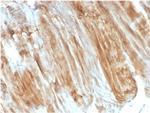 Dystrophin (DMD) Antibody in Immunohistochemistry (Paraffin) (IHC (P))