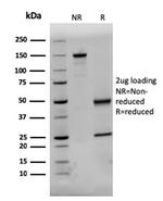 Dystrophin (DMD) Antibody in SDS-PAGE (SDS-PAGE)