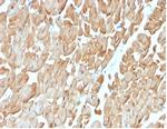 Dystrophin (DMD) (Marker of Duchenne and Becker Muscular Dystrophy) Antibody in Immunohistochemistry (Paraffin) (IHC (P))