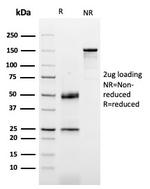 Dystrophin (DMD) (Marker of Duchenne and Becker Muscular Dystrophy) Antibody in SDS-PAGE (SDS-PAGE)