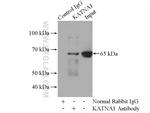 KATNA1 Antibody in Immunoprecipitation (IP)