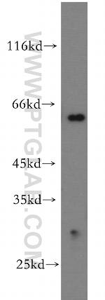 KATNA1 Antibody in Western Blot (WB)