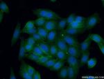 CD146/MCAM Antibody in Immunocytochemistry (ICC/IF)