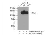 CD146/MCAM Antibody in Immunoprecipitation (IP)