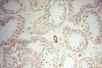 CD146/MCAM Antibody in Immunohistochemistry (Paraffin) (IHC (P))