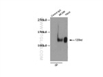 CD146/MCAM Antibody in Immunoprecipitation (IP)