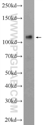 CD146/MCAM Antibody in Western Blot (WB)