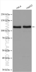 CD146/MCAM Antibody in Western Blot (WB)