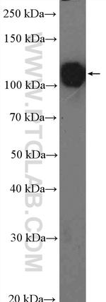 CD146/MCAM Antibody in Western Blot (WB)