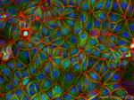 beta-Catenin Antibody in Immunocytochemistry (ICC/IF)