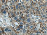 beta-Catenin Antibody in Immunohistochemistry (Paraffin) (IHC (P))