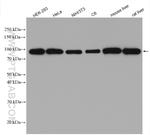 beta-Catenin Antibody in Western Blot (WB)