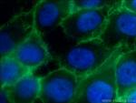 beta-Catenin Antibody in Immunocytochemistry (ICC/IF)