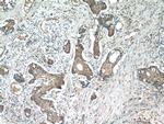 beta-Catenin Antibody in Immunohistochemistry (Paraffin) (IHC (P))