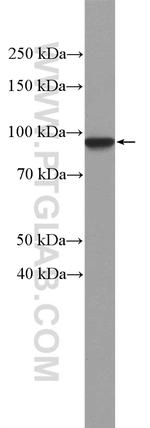 beta-Catenin Antibody in Western Blot (WB)