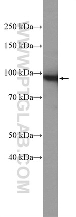 beta-Catenin Antibody in Western Blot (WB)