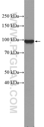 beta-Catenin Antibody in Western Blot (WB)