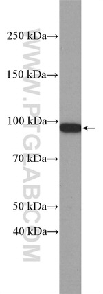 beta-Catenin Antibody in Western Blot (WB)