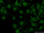 ACAP3 Antibody in Immunocytochemistry (ICC/IF)