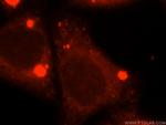 ACOX2 Antibody in Immunocytochemistry (ICC/IF)