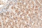 ACOX2 Antibody in Immunohistochemistry (Paraffin) (IHC (P))