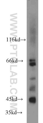 MAPK10 Antibody in Western Blot (WB)