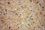 MDM1 Antibody in Immunohistochemistry (Paraffin) (IHC (P))