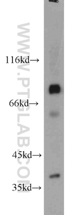 MDM1 Antibody in Western Blot (WB)