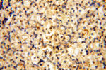 HRASLS5 Antibody in Immunohistochemistry (Paraffin) (IHC (P))