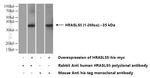 HRASLS5 Antibody in Western Blot (WB)