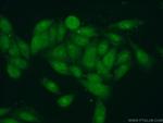 BXDC1 Antibody in Immunocytochemistry (ICC/IF)