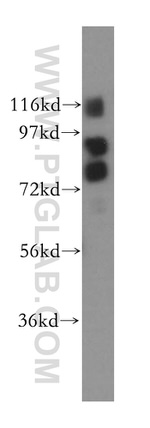 Gamma adducin Antibody in Western Blot (WB)