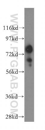 Gamma adducin Antibody in Western Blot (WB)