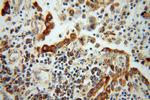 ATP5H Antibody in Immunohistochemistry (Paraffin) (IHC (P))