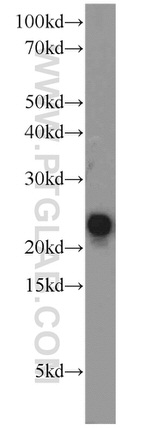 ATP5H Antibody in Western Blot (WB)